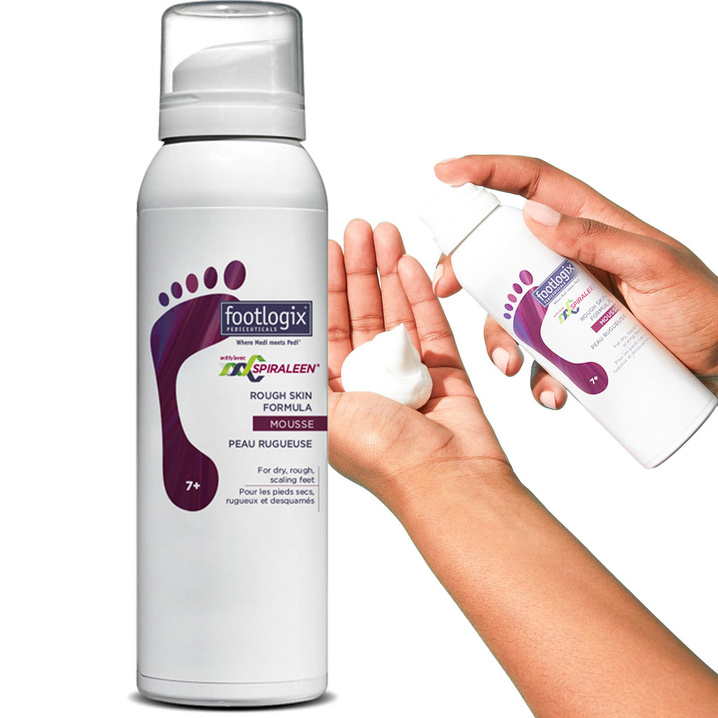 Footlogix Rough Skin Formula with Spiraleen Mousse – Dry Cracked Heels & Feet Care, 4.23oz