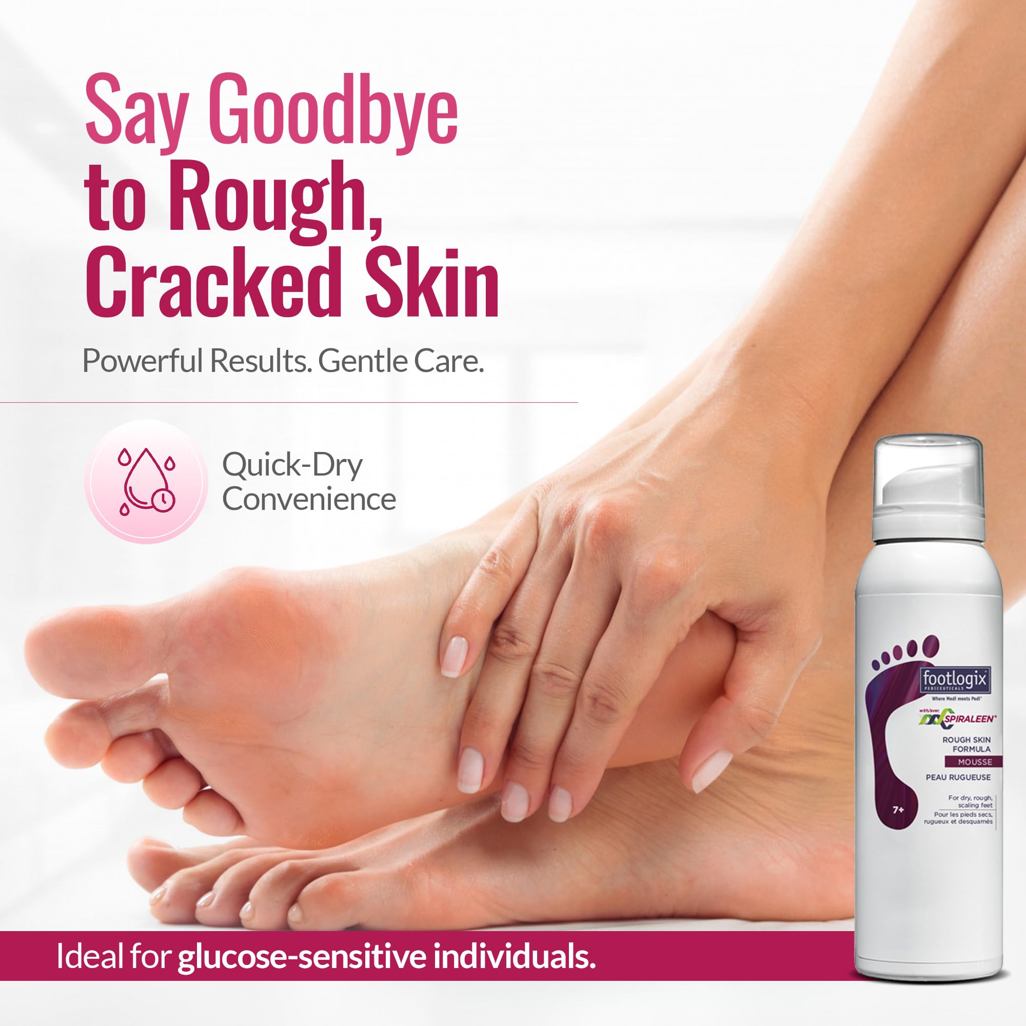 Footlogix Rough Skin Formula with Spiraleen Mousse – Dry Cracked Heels & Feet Care, 4.23oz