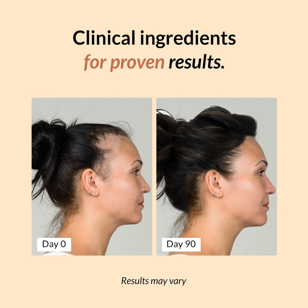FullyVital Hair Growth Supplement for Women 35+: Thicker, Fuller Hair – Vegan & Dermatologist Recommended