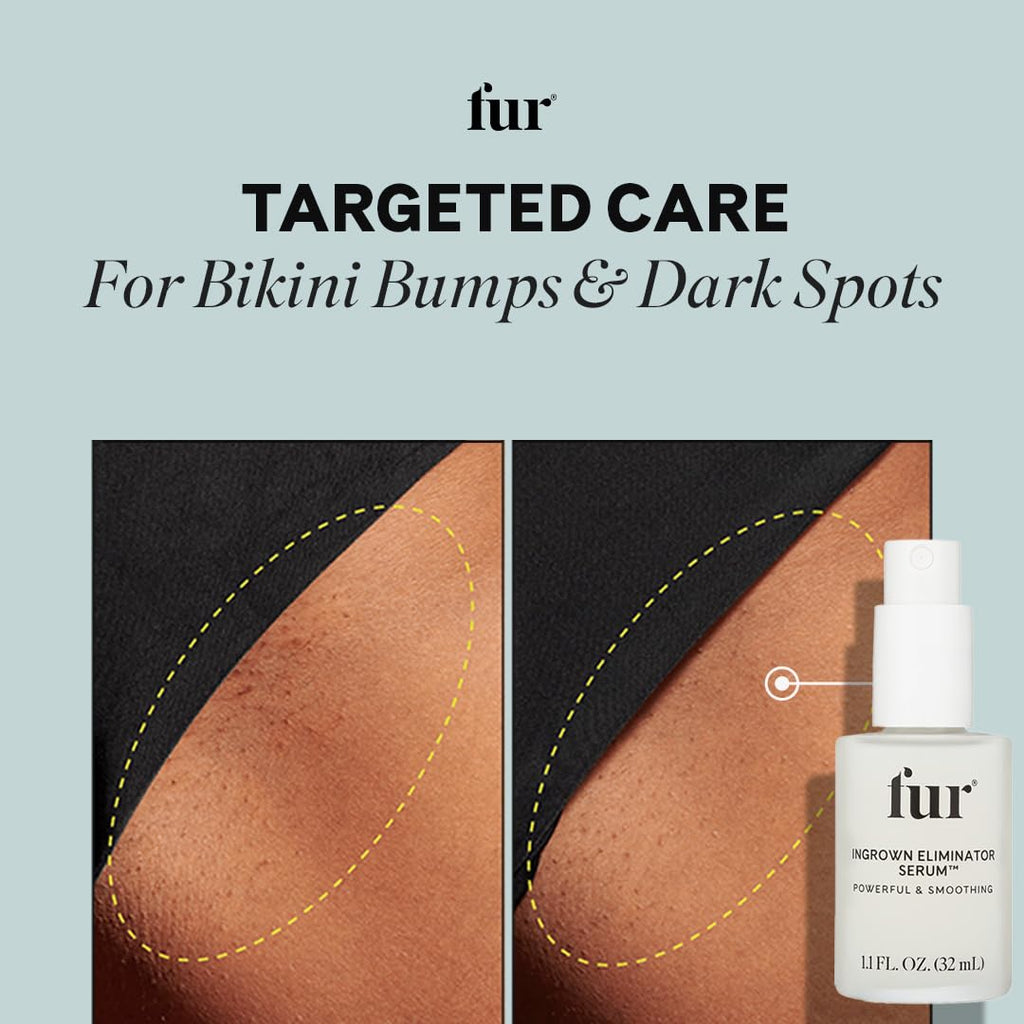 Fur Ingrown Eliminator Serum: Post-Hair Removal Care & Ingrown Treatment | 1.1 fl oz
