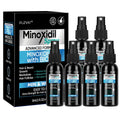 FUZYAT 5% Minoxidil Spray – Biotin-Enhanced Hair Growth for Men & Women, 180ml