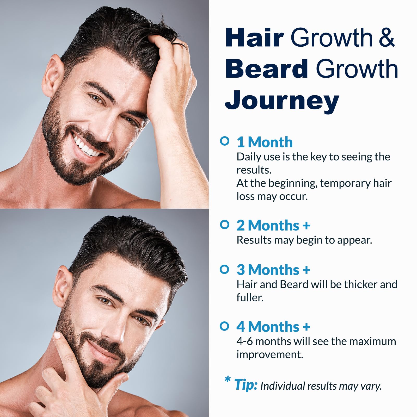 FUZYAT 5% Minoxidil Hair Growth Spray for Men & Women – 2-Pack
