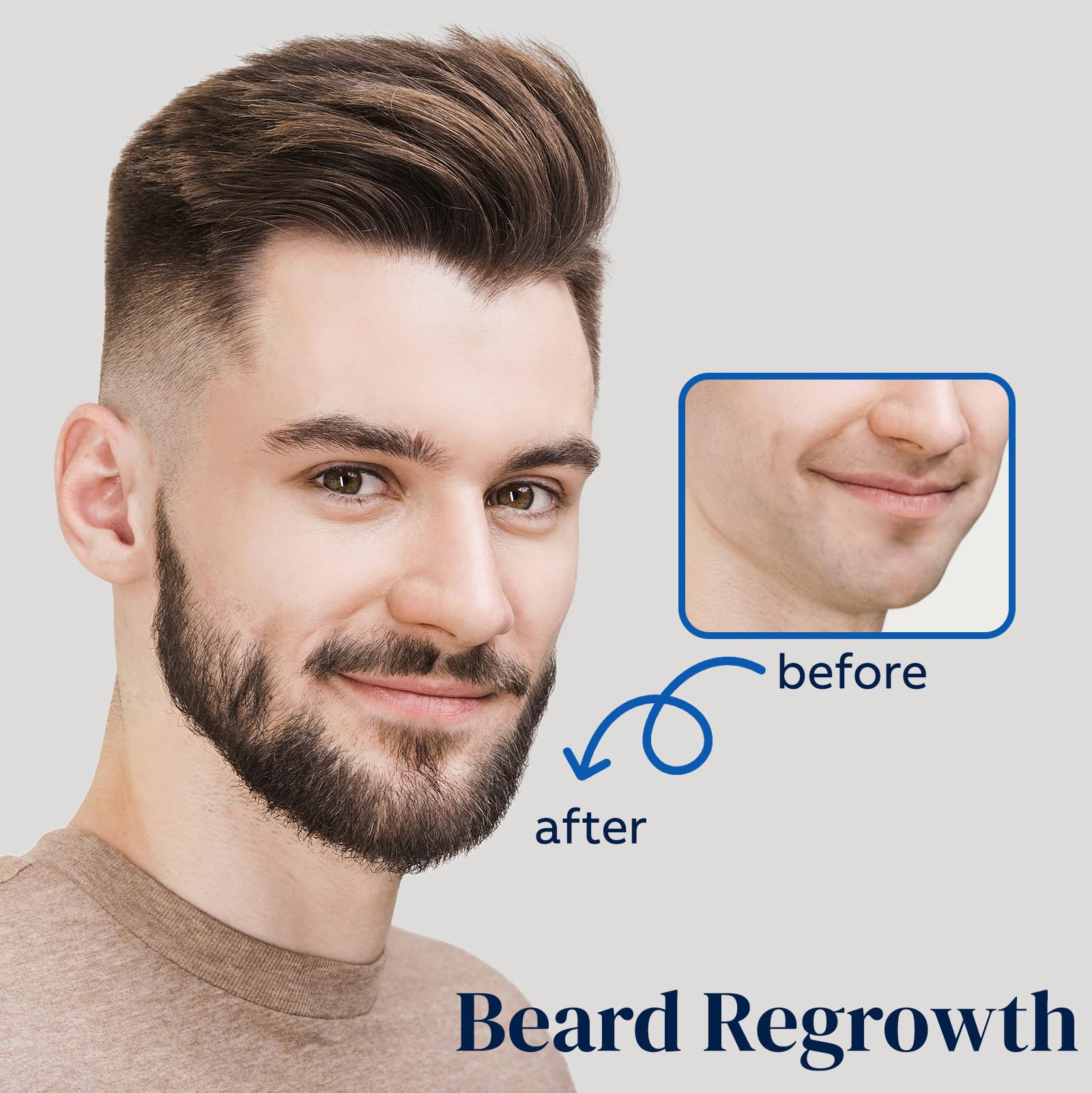 FUZYAT 5% Minoxidil Hair Growth Spray for Men & Women – 2-Pack