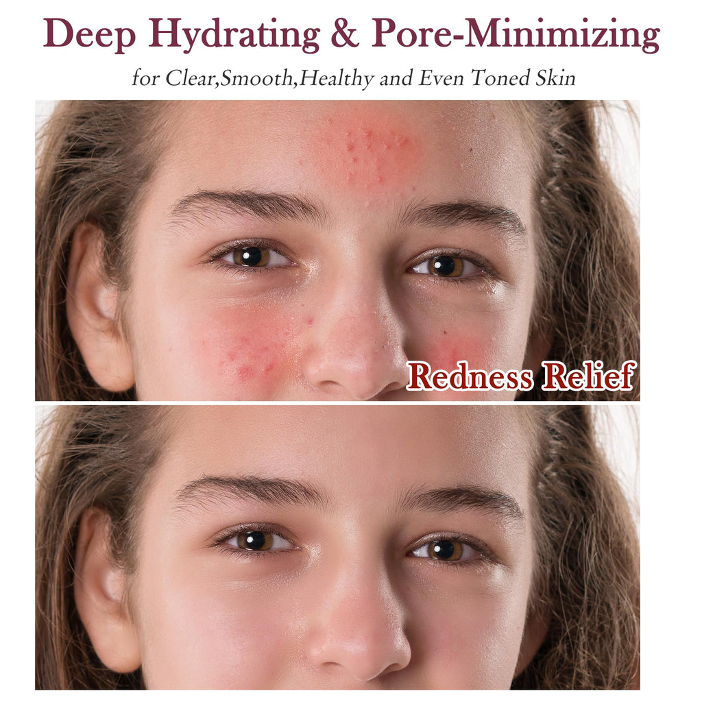 GEBEATY 6-Piece Skin Care Set for Teens & Women | Pore-Minimizing Glow