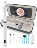 Sofbunny A03 Ear Wax Removal Tool with Screen – 1080P HD Otoscope Kit