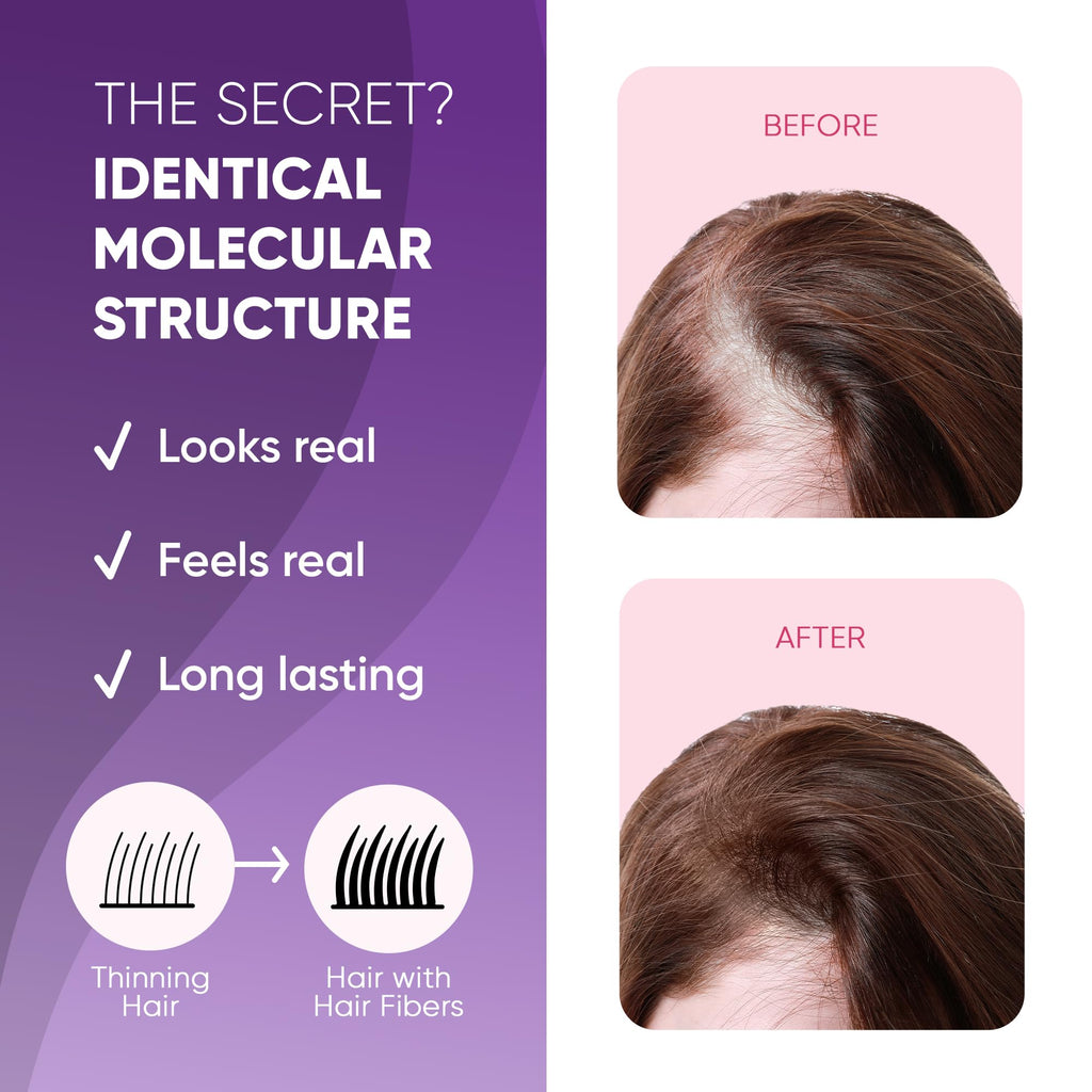 GBG Hair Fibers for Thinning Hair & Bald Spots (Dark Blonde) – 25g | Instant Coverage & Volume | Get Back Gorgeous | Cruelty Free