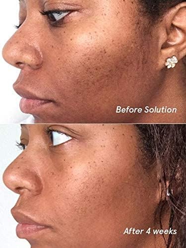 Glossier Solution Exfoliating Skin Perfector – 4.4 fl oz / 130 ml