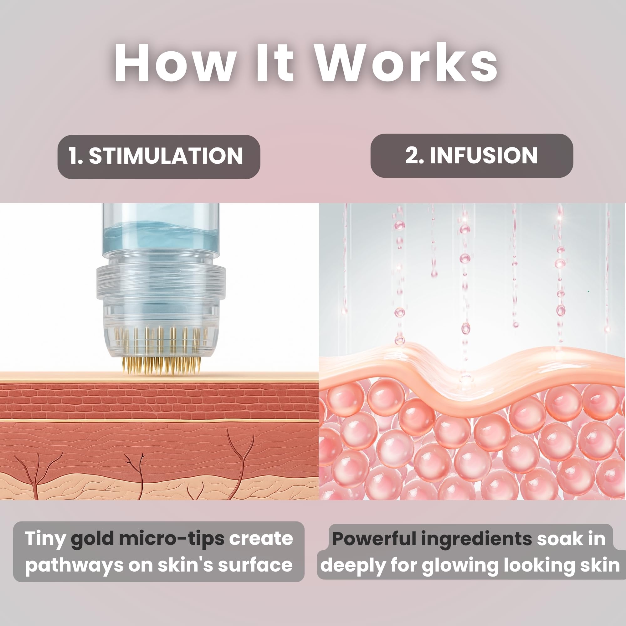 Glov Beauty Micro Infusion System – 0.25mm Gold Facial Stamp with Hyaluronic Serum (4 Infusions, 12 Ampoules)