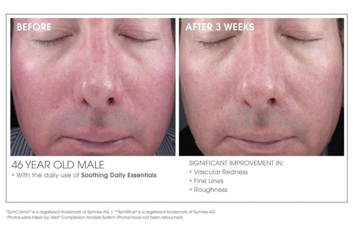 Glowbiotics Calming Restorative Treatment – Probiotic Redness Relief Serum