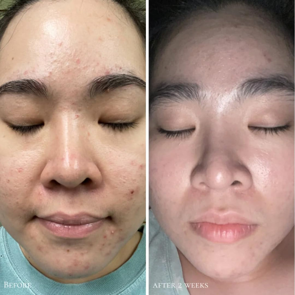 Glowbiotics Probiotic Triple Action Clarifying Pads – 5% Glycolic, 2% Lactic, 2% Salicylic, 60 Pads