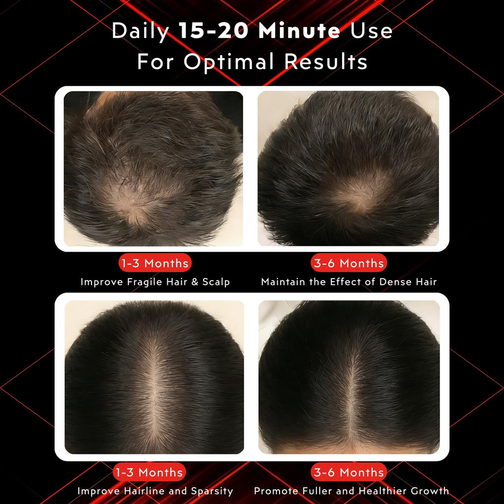 GlowFars Red Light Hair Growth Cap – Wireless, 4-Wavelength + Pulse Mode