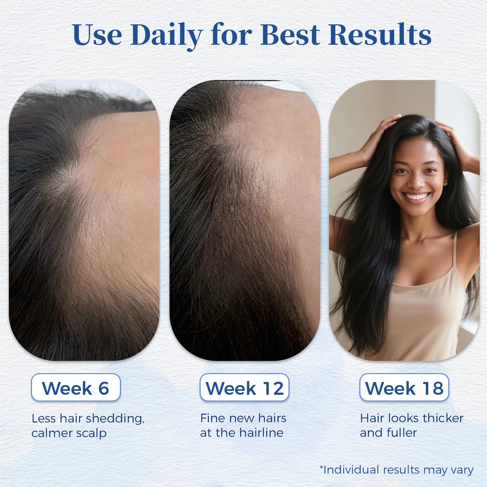 Gluvelessia Hair Growth Serum Roll-On with Rosemary + Saw Palmetto – Thicker Look (Pack of 2)