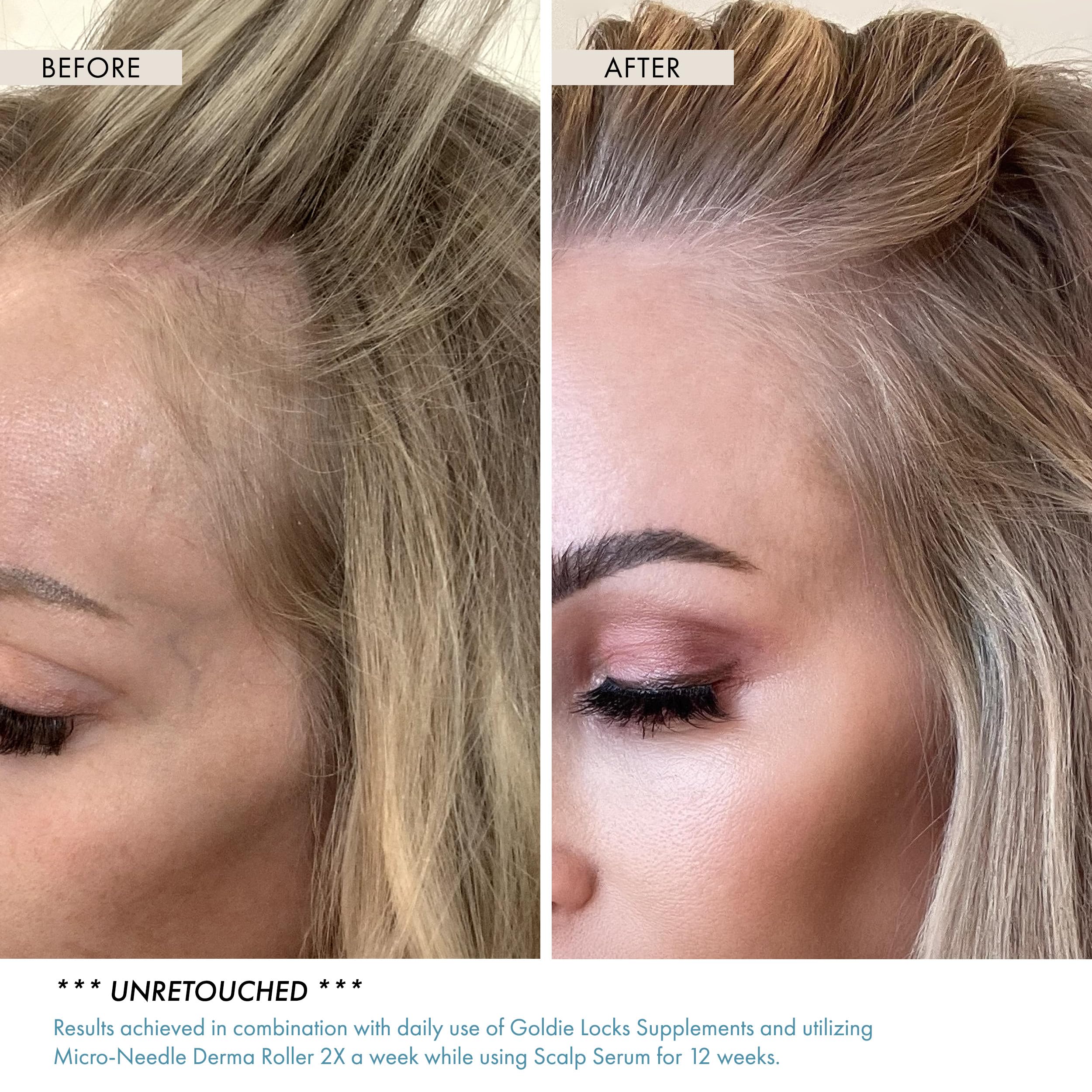 Goldie Locks Scalp Serum | Fuller-Looking Hair & Healthy Scalp, Lightweight Hydration