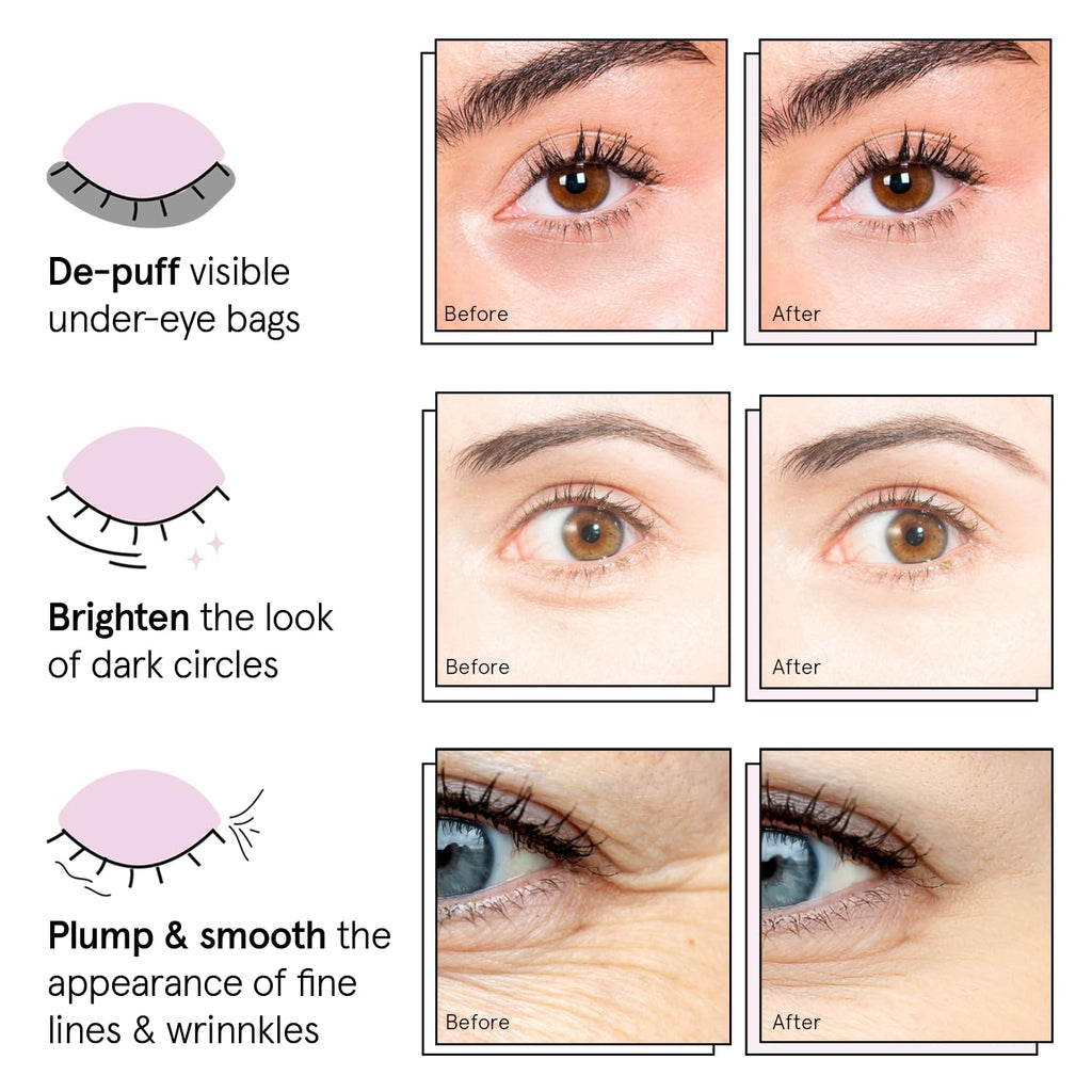 Grace & Stella Under Eye Patches (12 Pairs) – Brighten Dark Circles, Puffiness | Vegan & Cruelty-Free