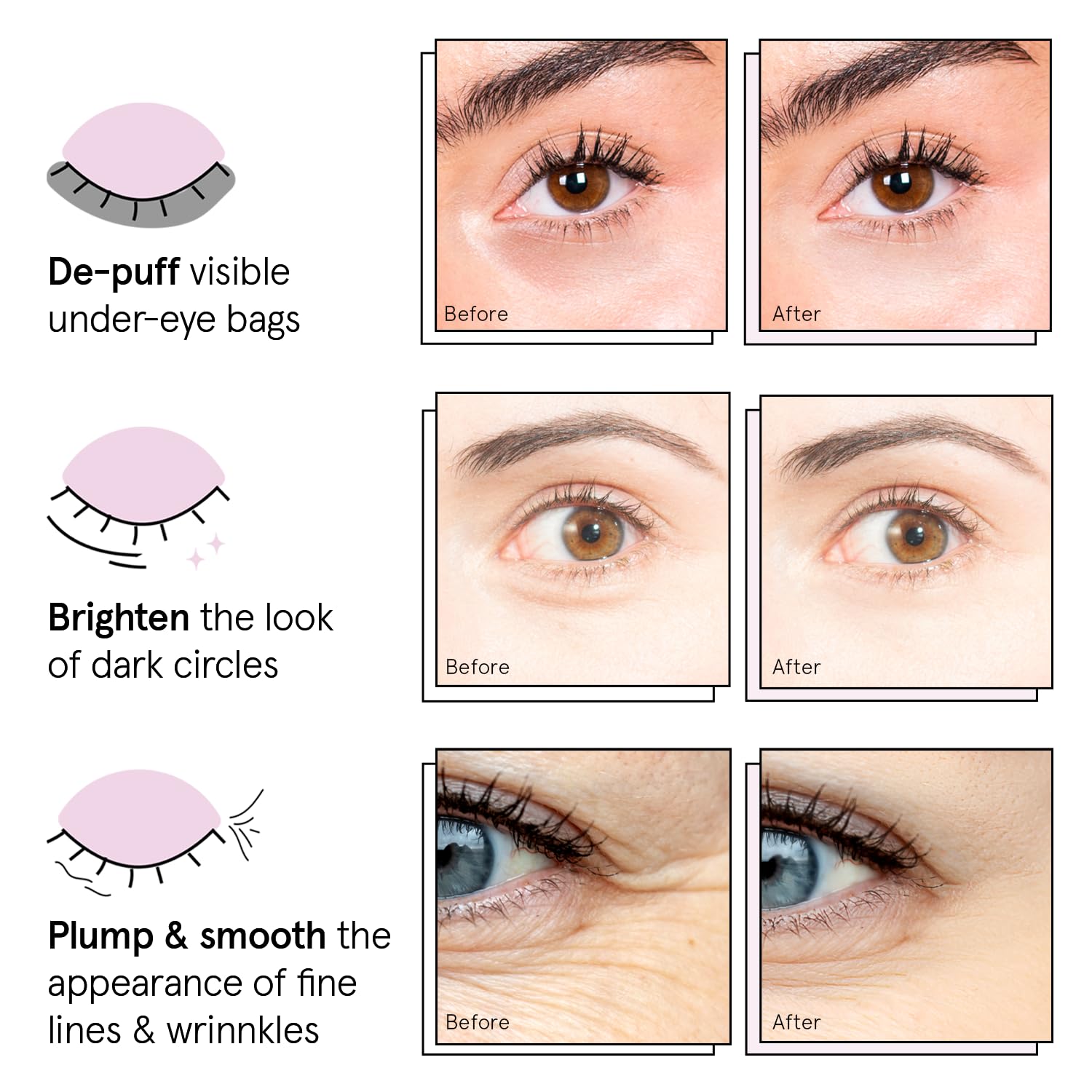 Grace & Stella Under Eye Patches (12 Pairs) – Brighten Dark Circles, Puffiness | Vegan & Cruelty-Free