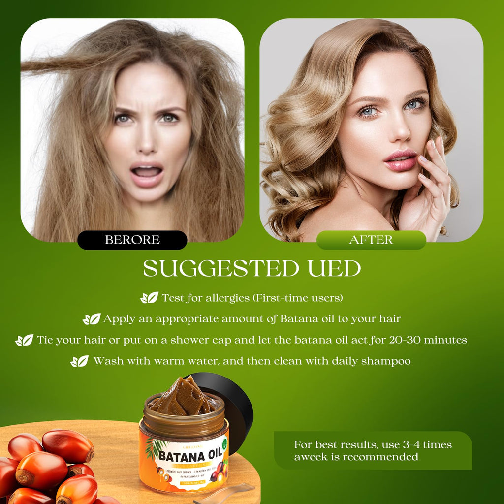 GREEONIL Batana Oil for Hair Growth – 100% Pure, Unrefined Batana Oil (5.3 oz)