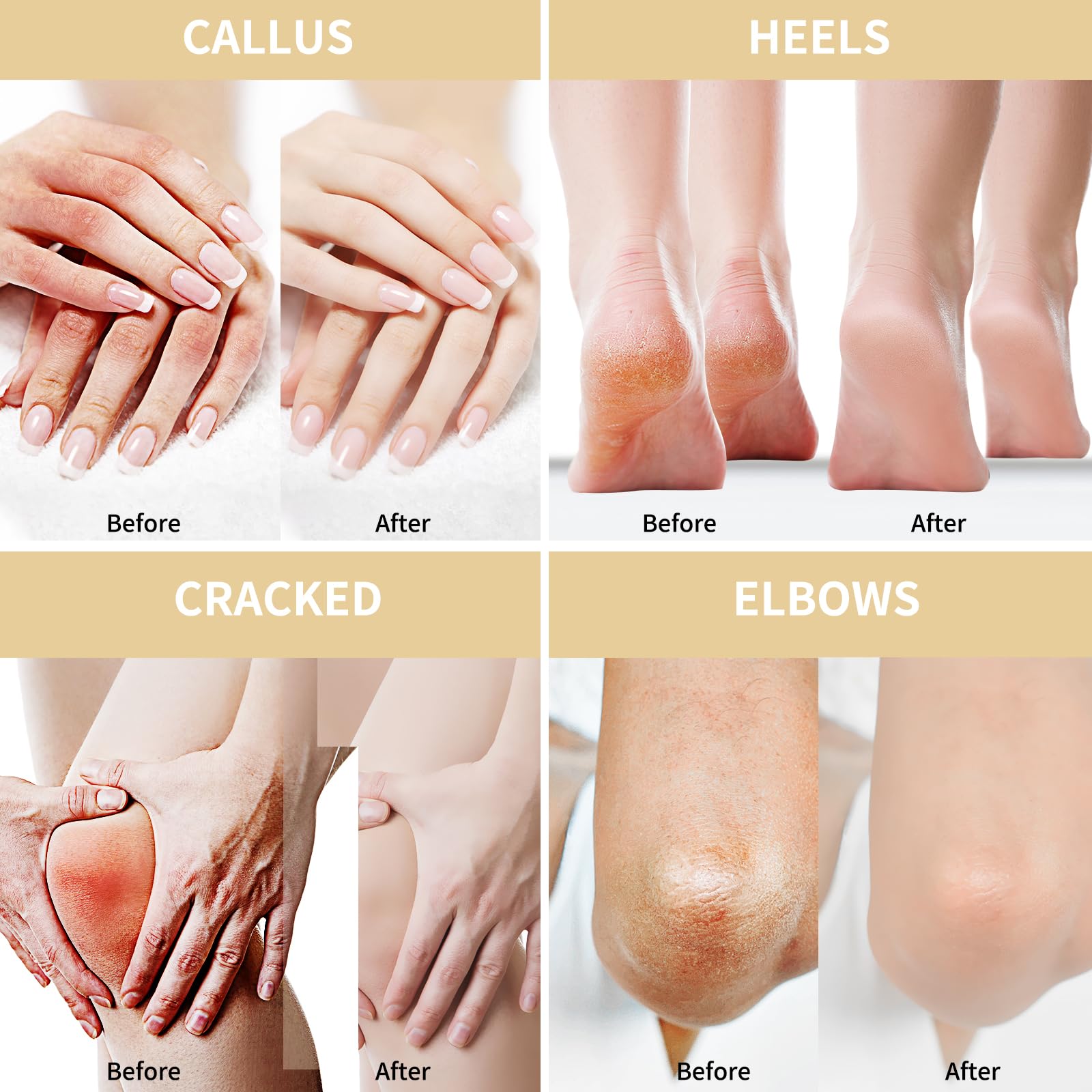 Grocerism Urea Cream 50% for Feet – 5.29 oz Two-Pack with Oat & 2% Salicylic Acid