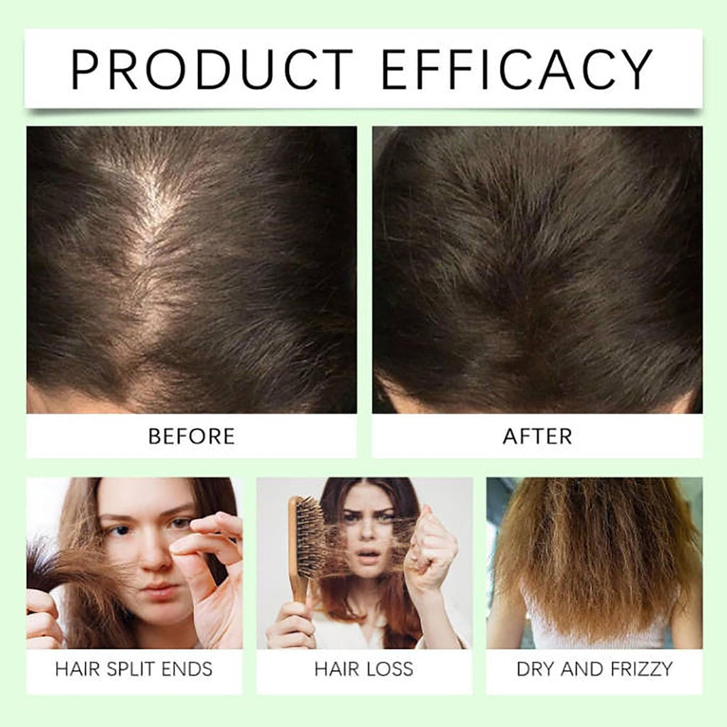 Grospe Anti-Hair Fall Shampoo | Nourishing Botanical Blend for All Hair Types – 3.52 oz