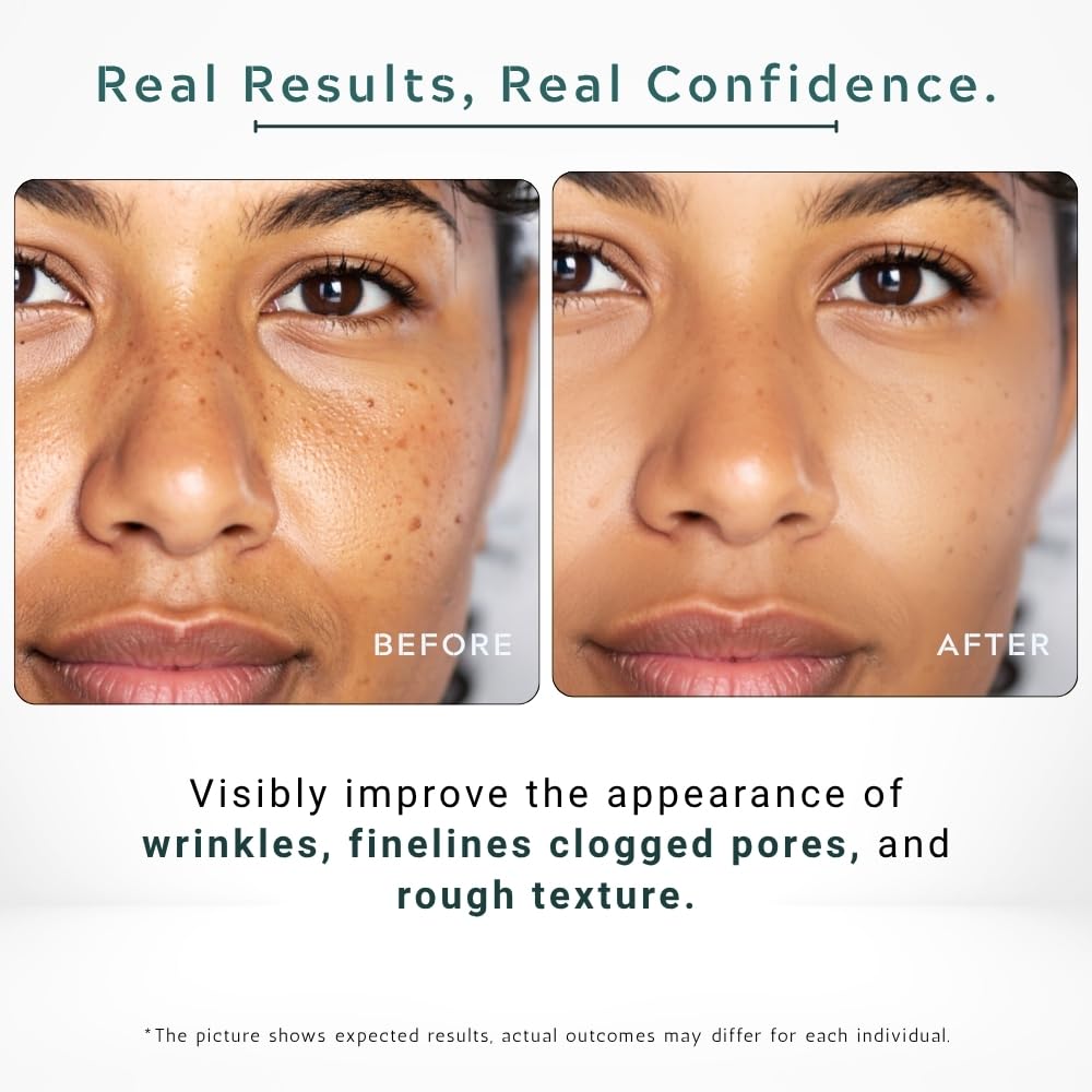 Gutaderme Vitamin C Serum 23% with Retinol & Salicylic Acid — 1 fl oz