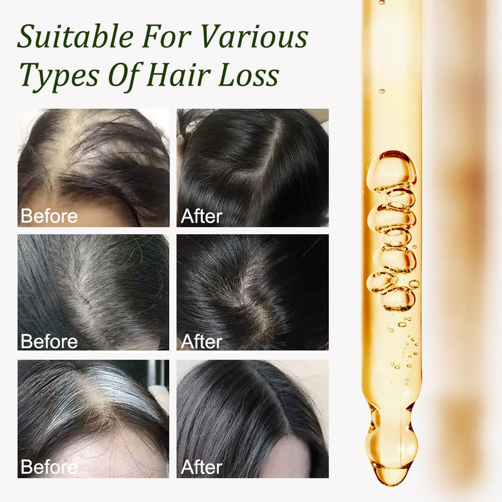 Gypsophila Batana Oil for Hair Growth – 100% Pure, Scalp Nourishment (2 Pack)