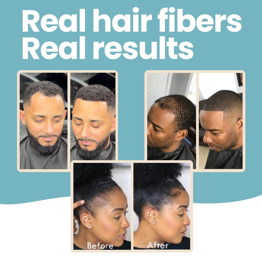 Hair Illusion 100% Natural Hair Fibers – Jet Black, 38 g Bottle