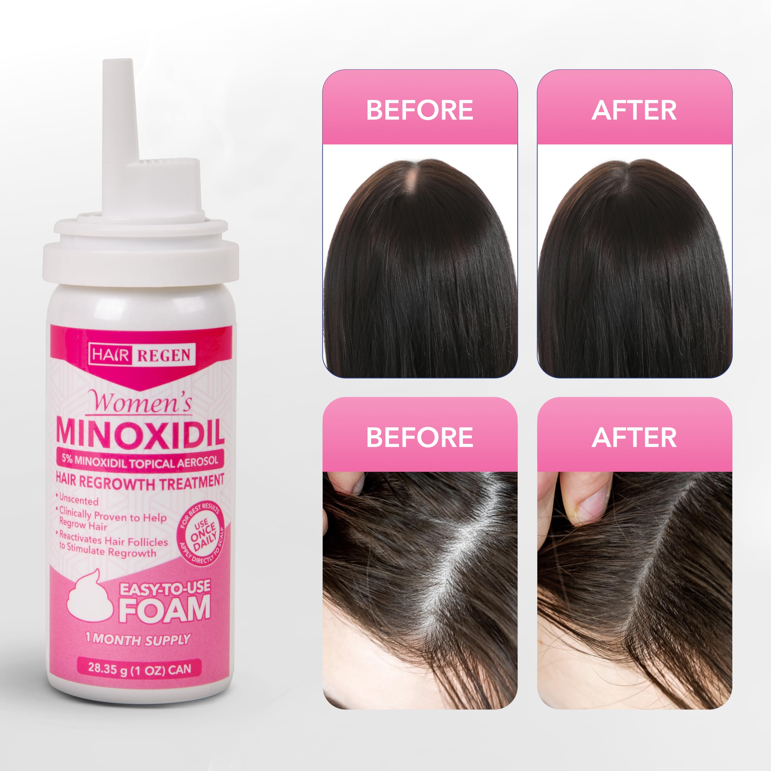 Hair Regen Minoxidil Foam for Women 5% – 6 Month Supply