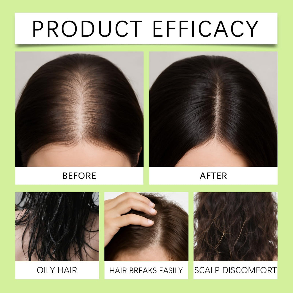 Hair Regrowth System | Advanced Biotin & Ginseng Serum for Thicker Hair