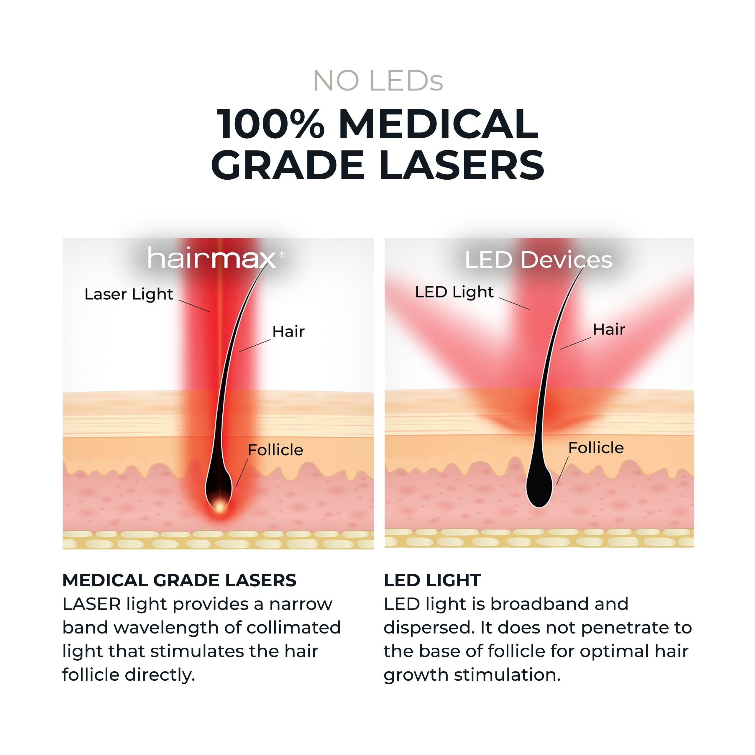 HairMax Laser Band 41 – FDA-Cleared Red Light Therapy Device for At-Home Hair Growth