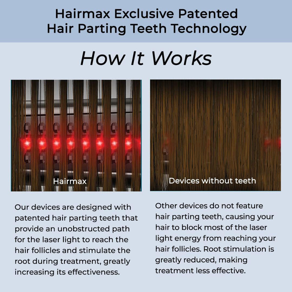 Hairmax Ultima 12 LaserComb – FDA Cleared Cordless Hair Growth Device