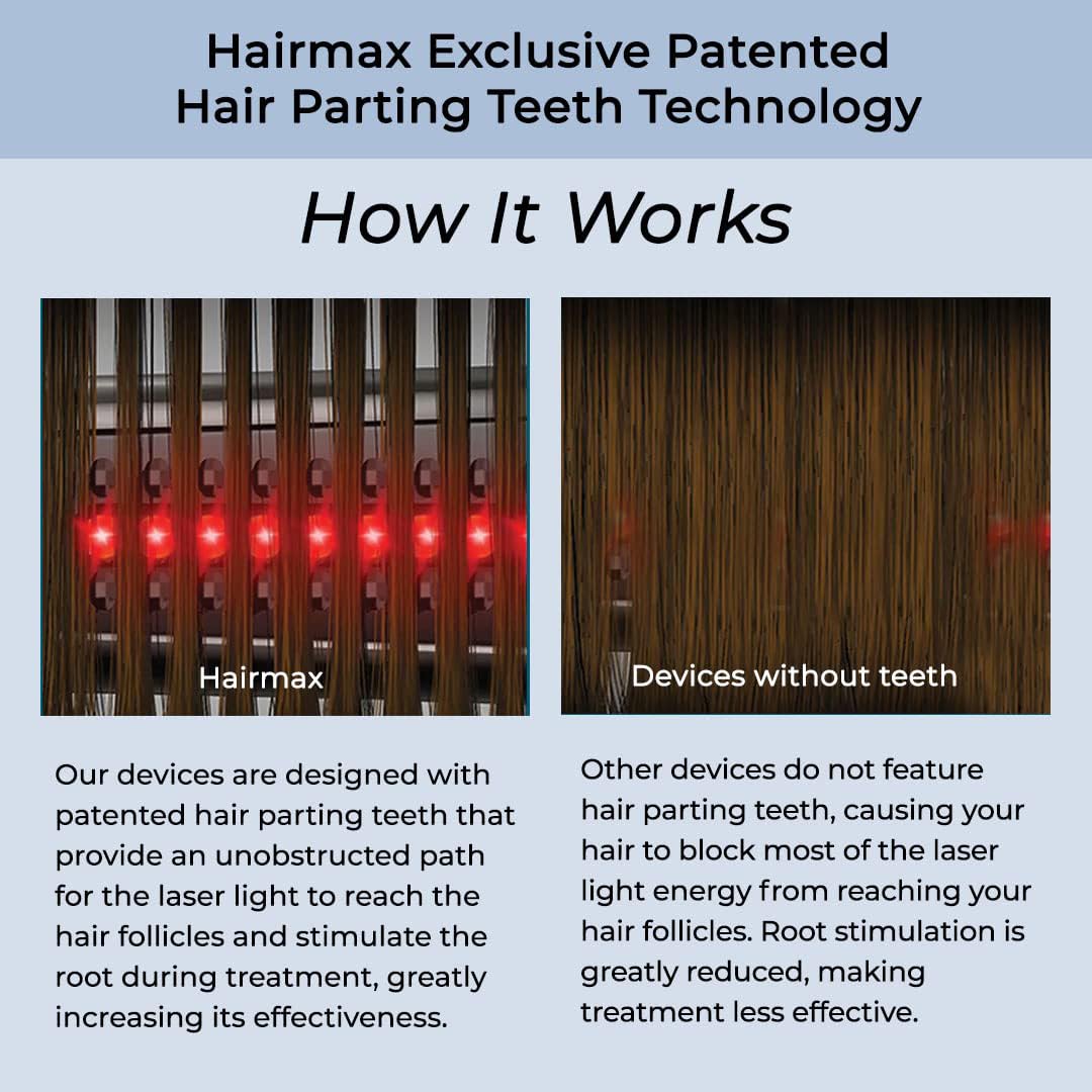 Hairmax Ultima 12 LaserComb – FDA Cleared Cordless Hair Growth Device