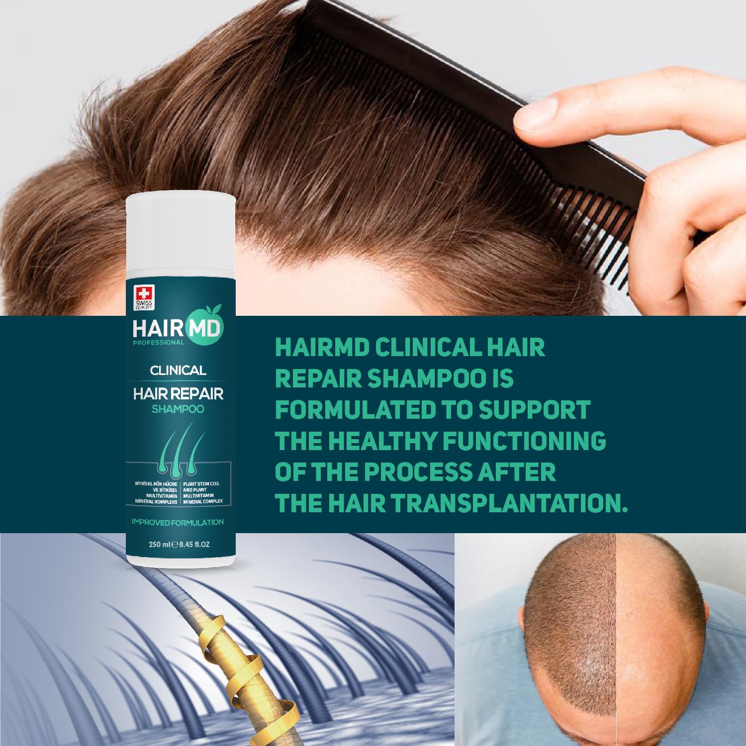 HairMD Transplant Clinical Repair Shampoo – 250ml Biotin Shampoo for Post-Transplant Scalp Care and Hair Growth