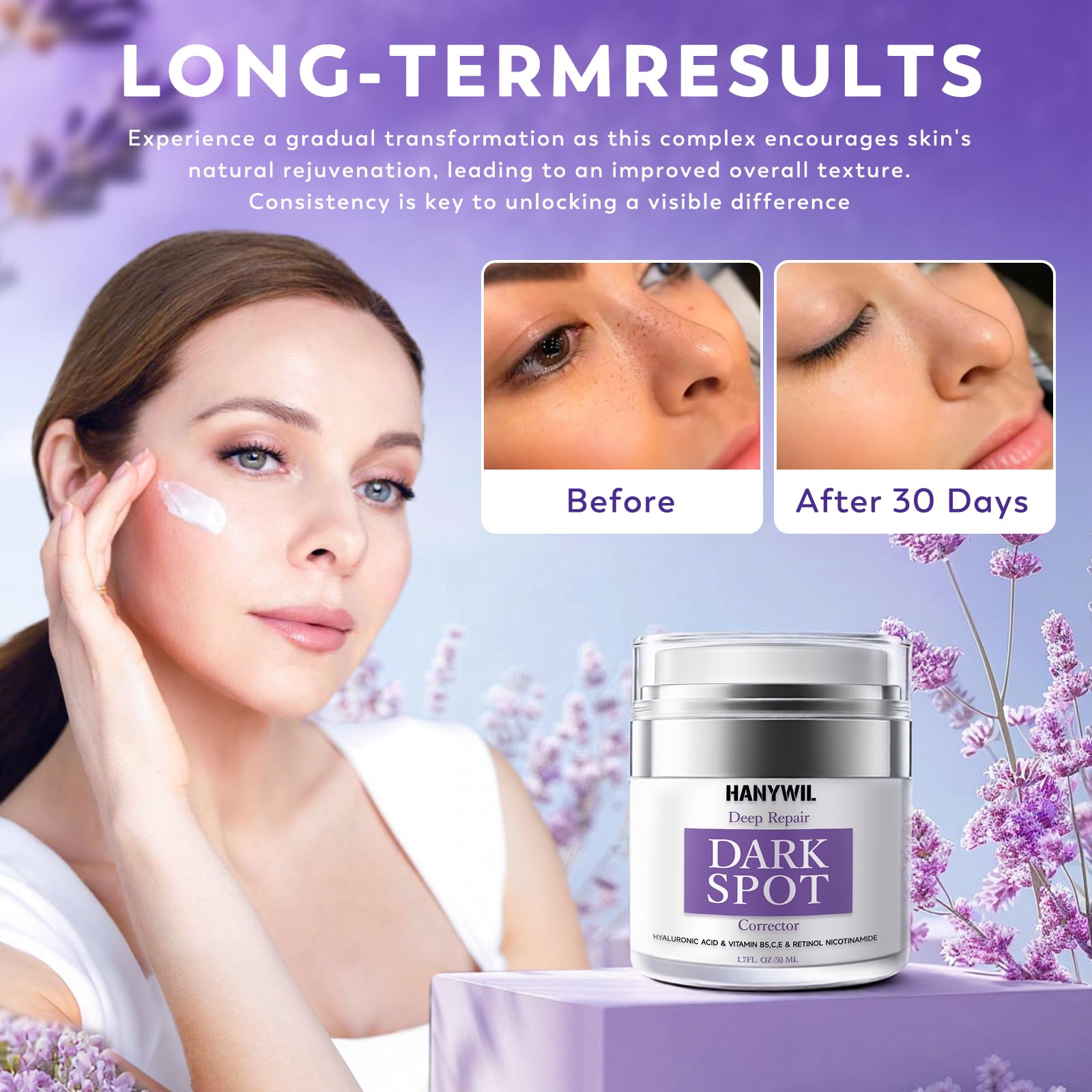 HANYWIL Dark Spot Remover for Face & Body — Natural Ingredients, Niacinamide + Vitamin E
