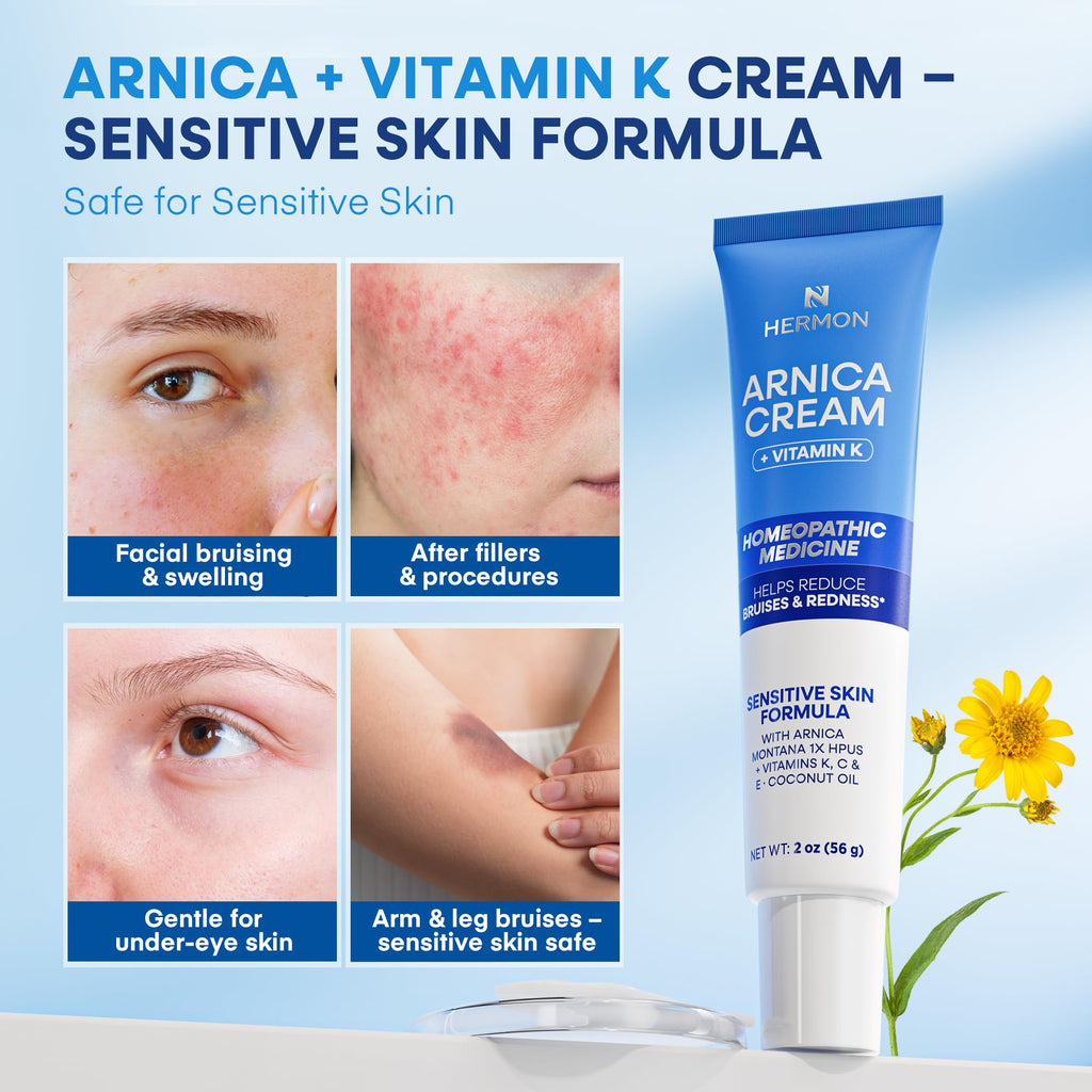 Hermon Arnica Bruise Cream with Vitamin K – Sensitive Skin & Face Formula, Extra Strength Hydrating Moisturizer 2 Oz
