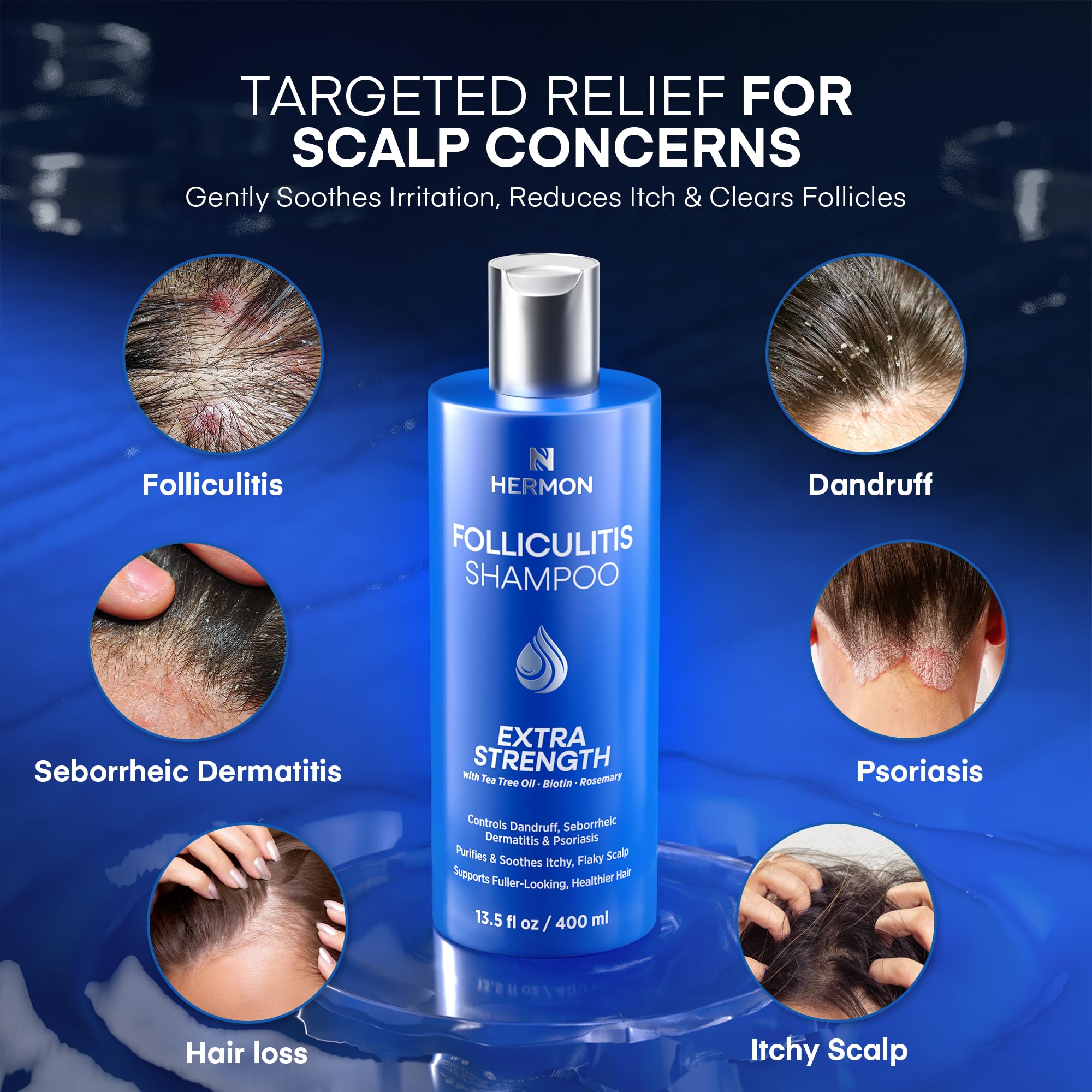 Hermon Folliculitis Treatment Kit: Shampoo & Tea Tree Soap for Scalp, Body & Intimate Areas