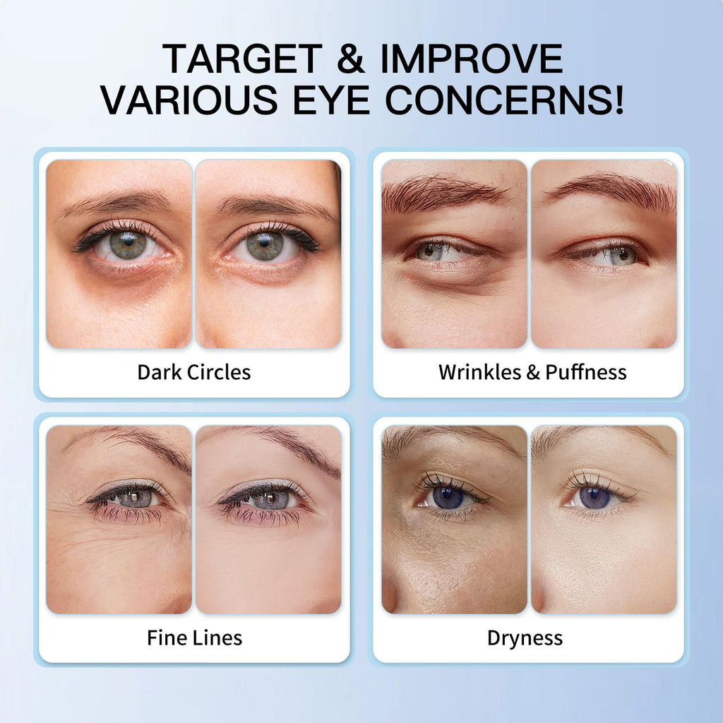 HGTG Eye Serum 5% Caffeine & 5% Retinol | Dark Circles, Puffiness, Fine Lines