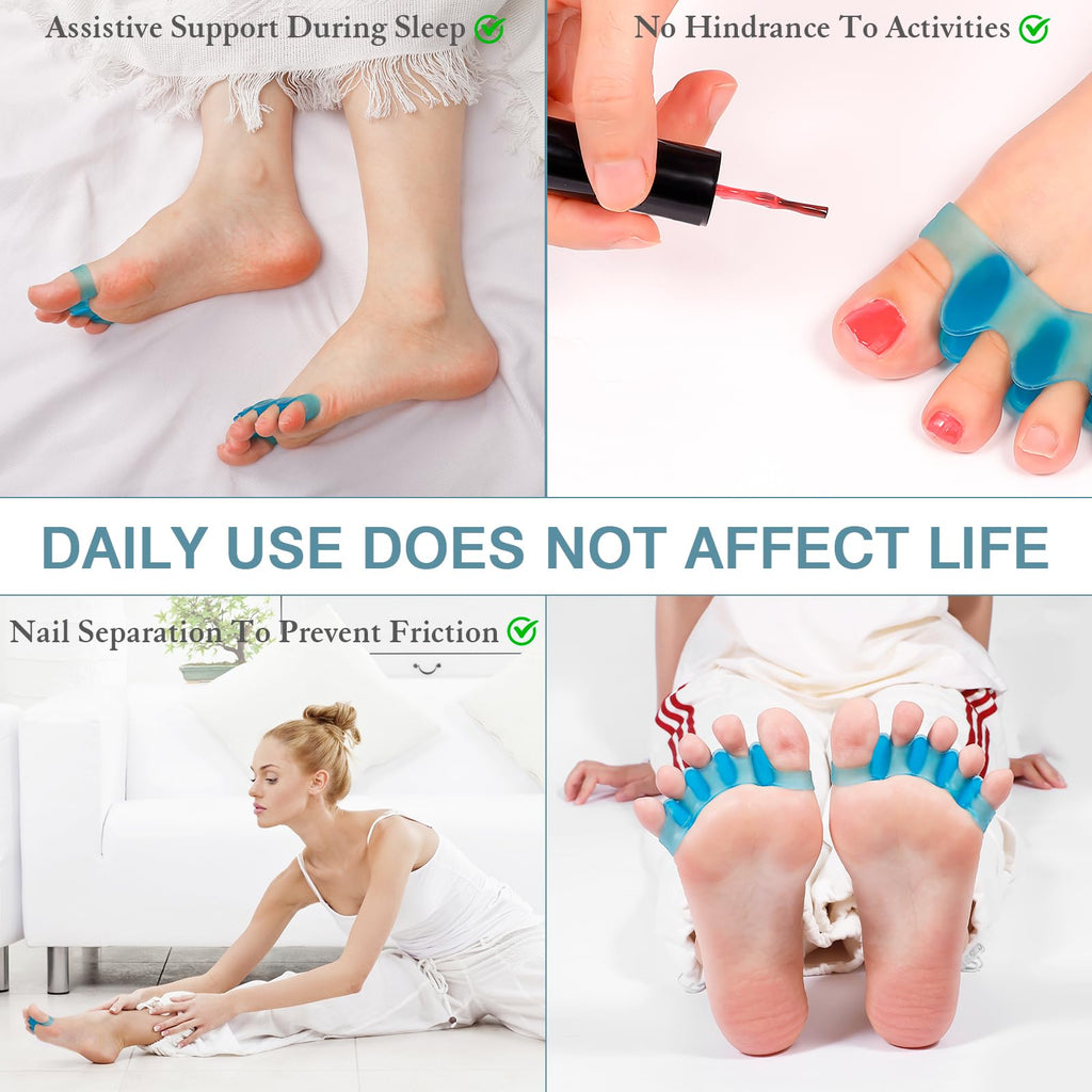 HLOES Toe Spacers 2-Pack – Unisex Toe Separators (Blue)