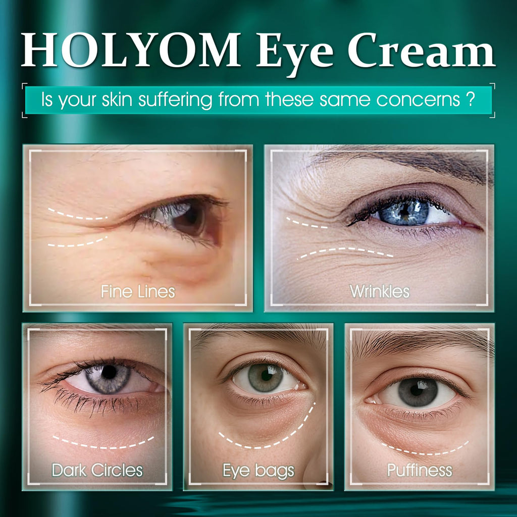 HOLYOM Advanced Eye Cream – Targeted Puffiness, Dark Circles & Wrinkles (1 oz)
