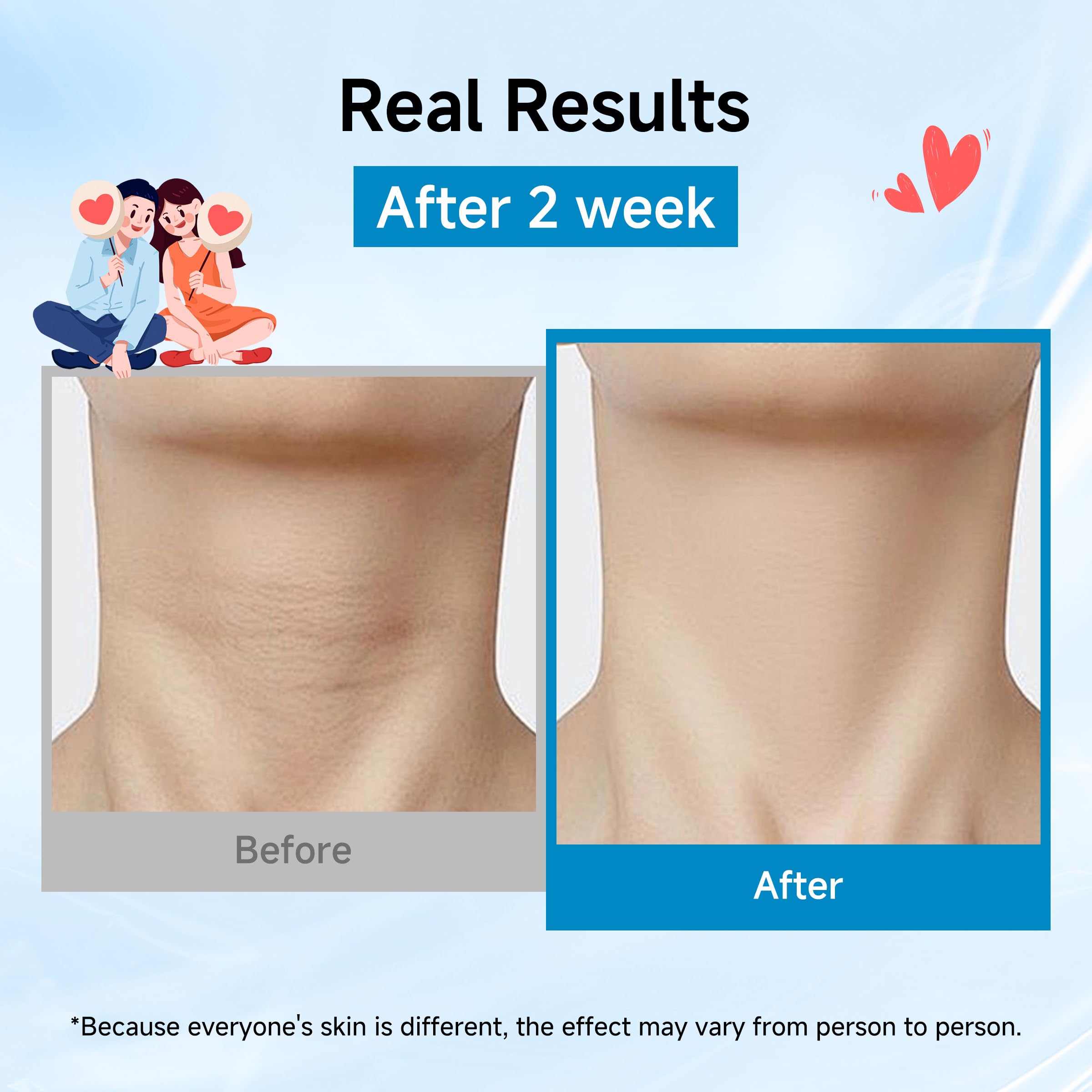 HONLINK Neck Mask 8-Pcs Set | Hydrating Collagen, Hyaluronic Acid & Peptide for Firmer, Smoother Neck