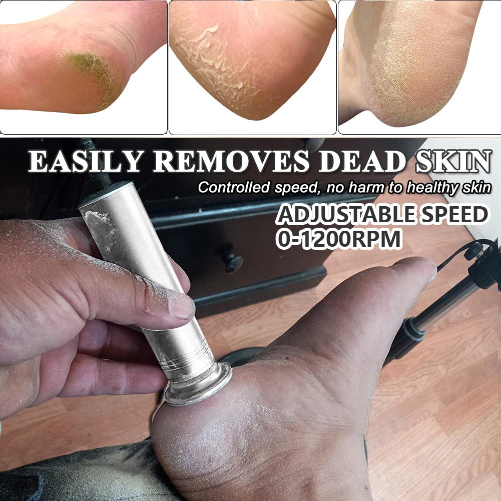 I·B·N G Upgraded Electric Callus Remover — 1200RPM, 60 Replaceable Discs, Adjustable Foot File