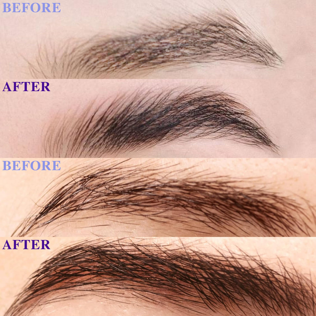 ICIKOL Eyebrow Growth Serum – 8ml Value Size, Vegan & Prostaglandin-Free