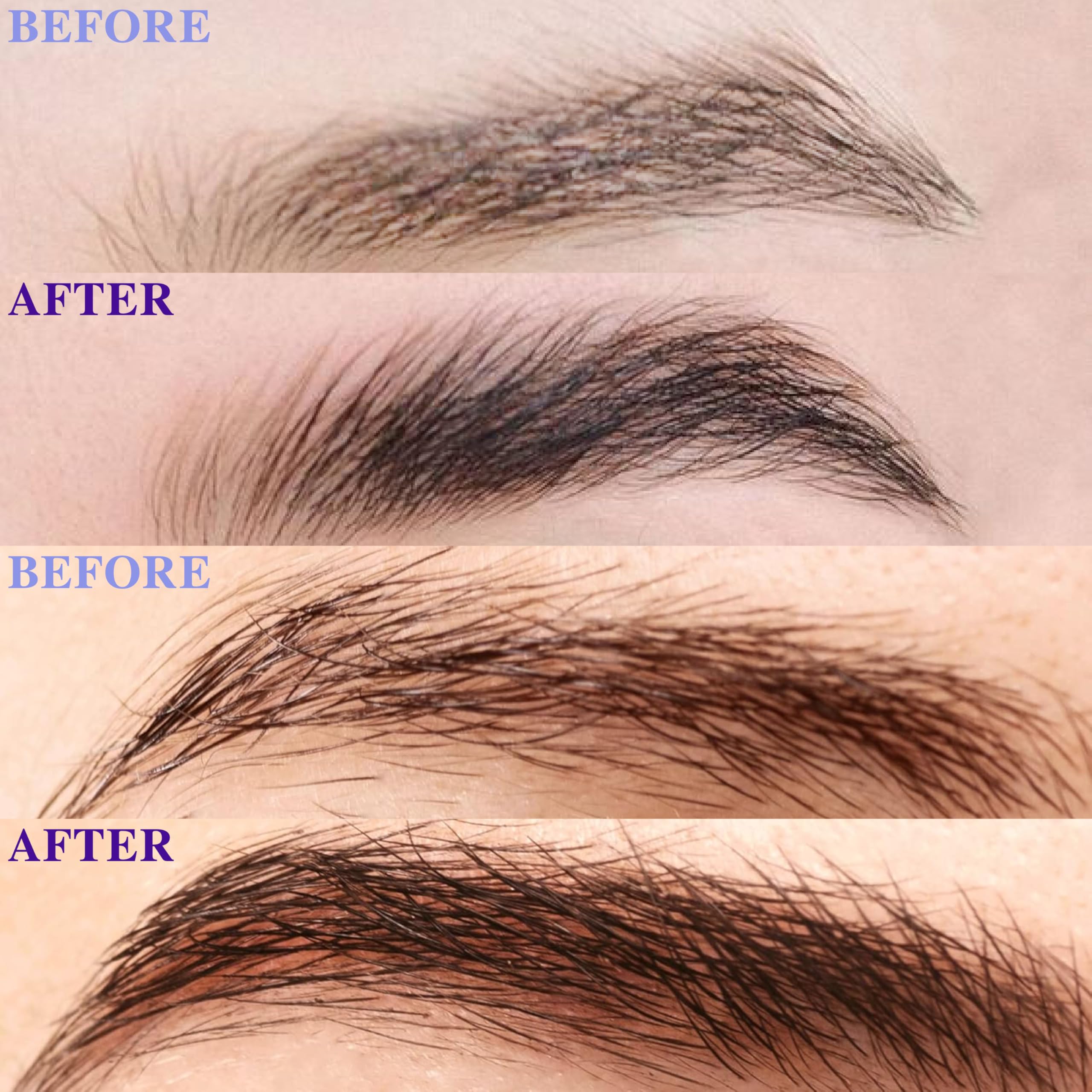 ICIKOL Eyebrow Growth Serum – 8ml Value Size, Vegan & Prostaglandin-Free