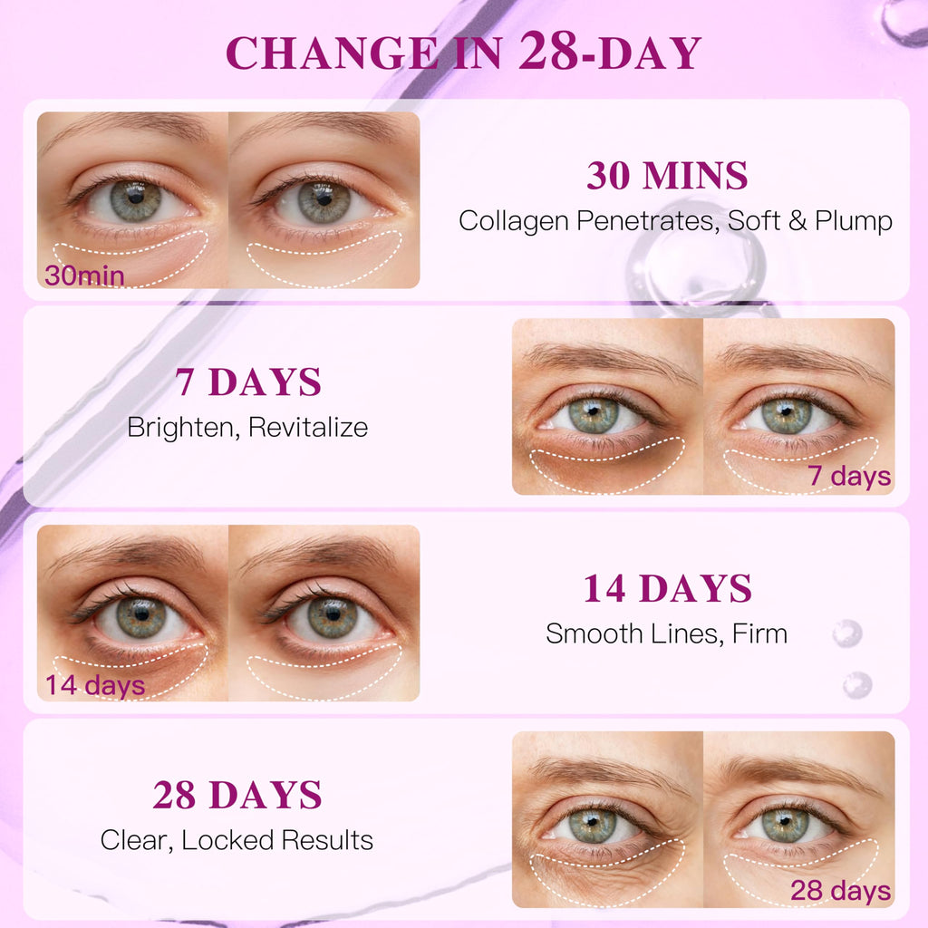 ICIKOL Collagen Under Eye Patches Mask – Deep Hydration & Puffiness Reduction (12 Pairs, Pearl Powder)