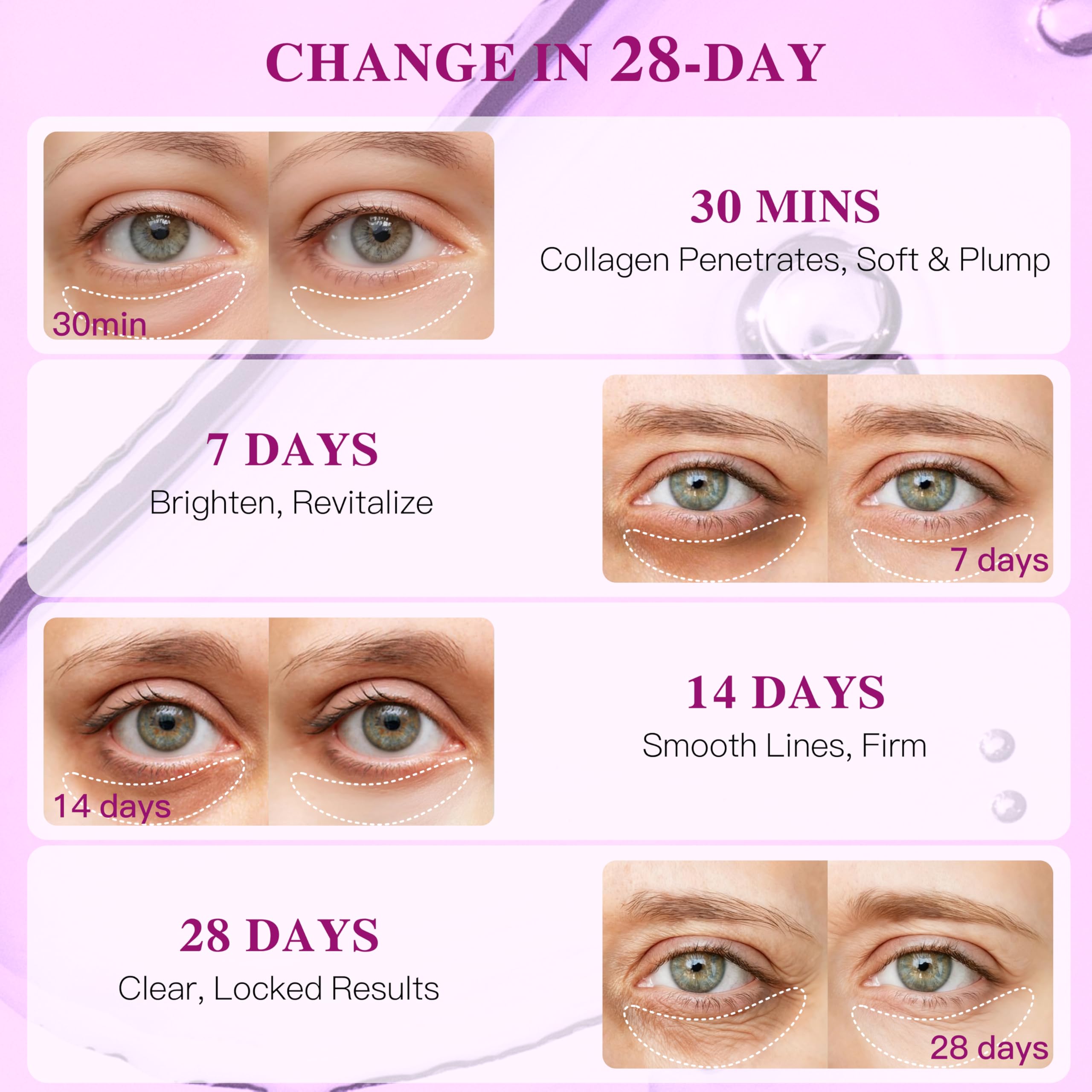 ICIKOL Collagen Under Eye Patches Mask – Deep Hydration & Puffiness Reduction (12 Pairs, Pearl Powder)