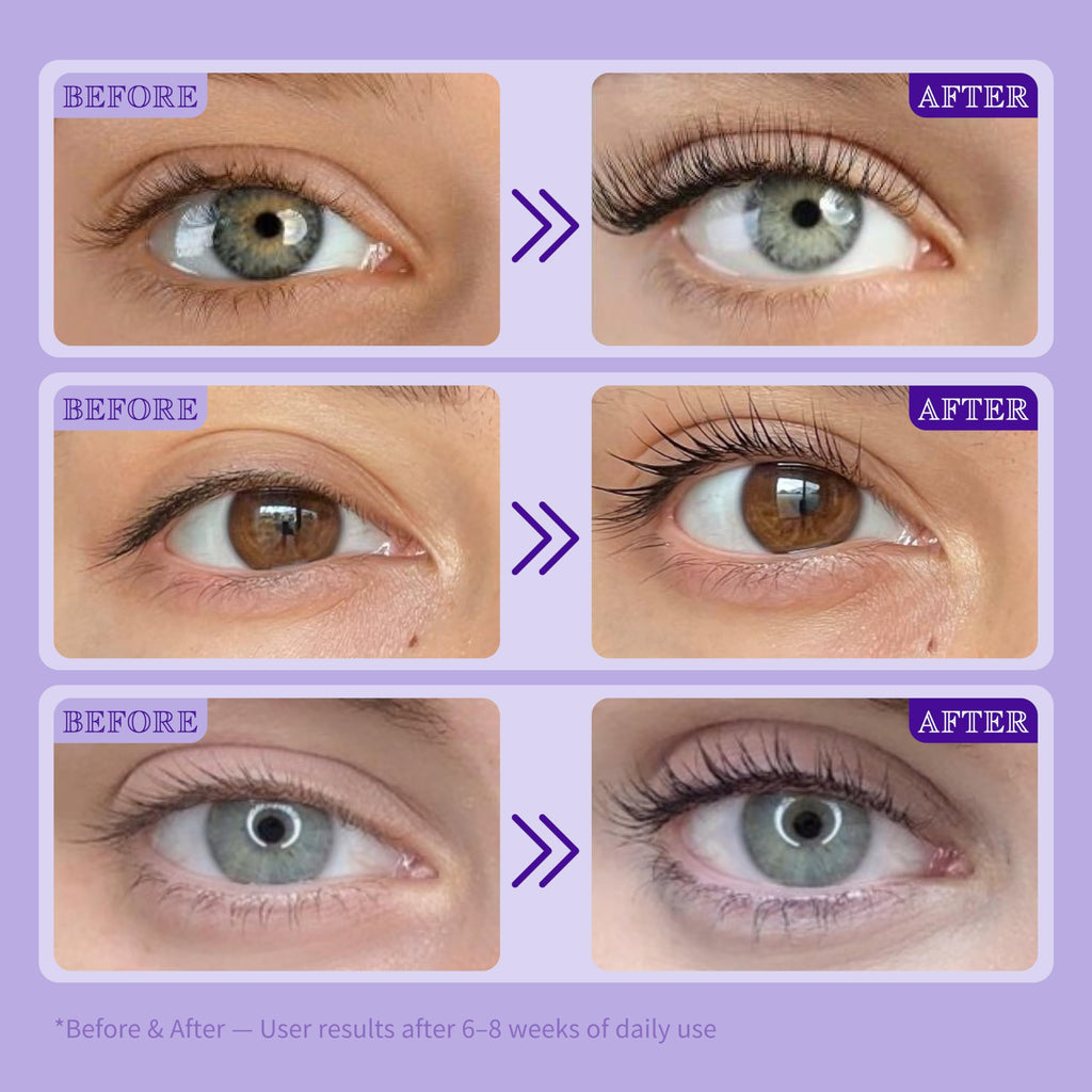ICIKOL Lash Serum for Eyelash Growth | Advanced Peptide & Biotin Formula, Prostaglandin-Free, 16mL