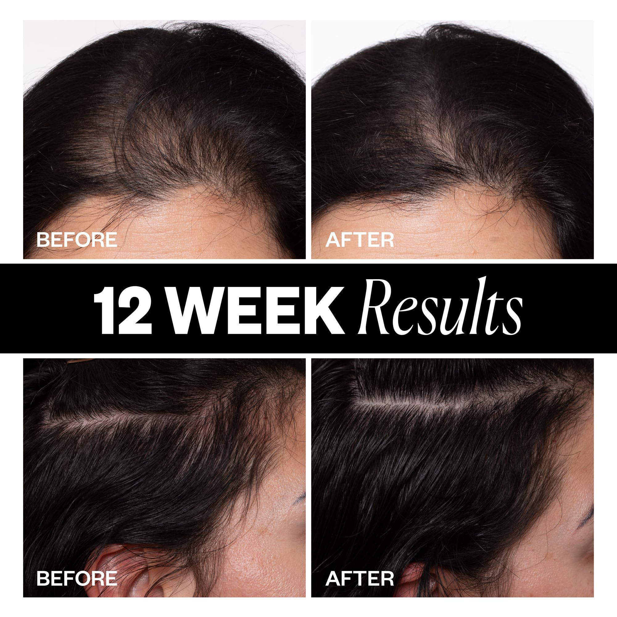 IGK Sponsored Scalp Treatment for Hair Growth – Serum-in-Mist for Fuller, Thicker Hair (2.1oz)