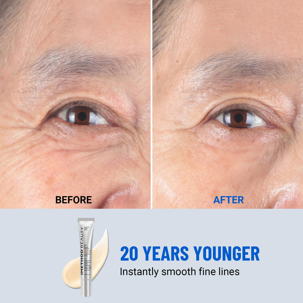iMethod Perfection Eye Tightener - Instant Under-Eye Firming Cream, Reduces Puffiness & Dark Circles, 20ml