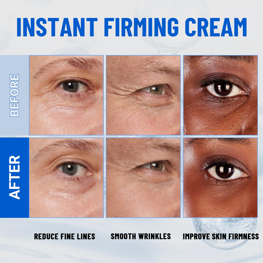 iMethod Perfection Eye Tightener - Instant Under-Eye Firming Cream, Reduces Puffiness & Dark Circles, 20ml