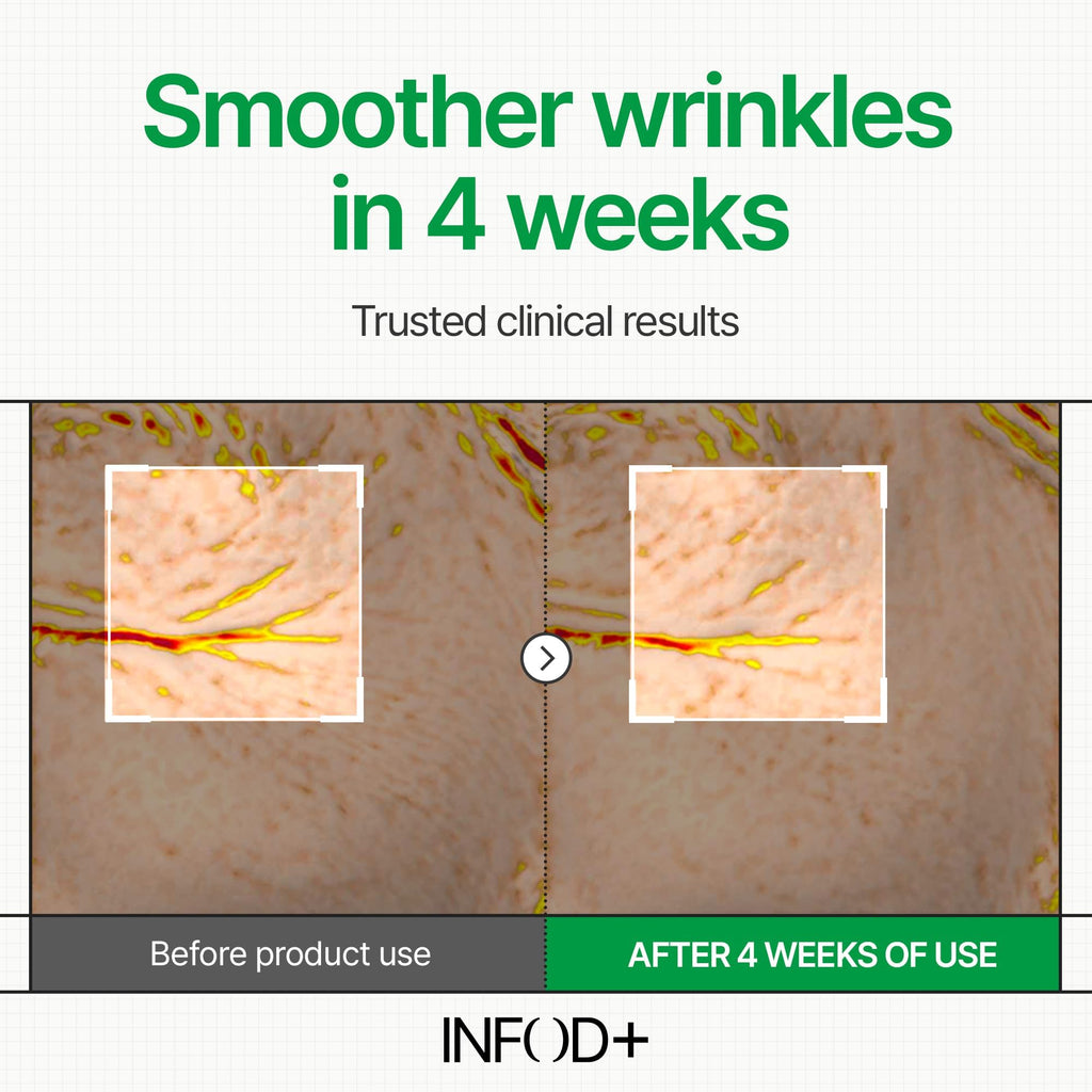 INFODPLUS Korean Skin Care Sensitive Face Cream – Lightweight Ceramides & Panthenol Moisturizer (50ml)