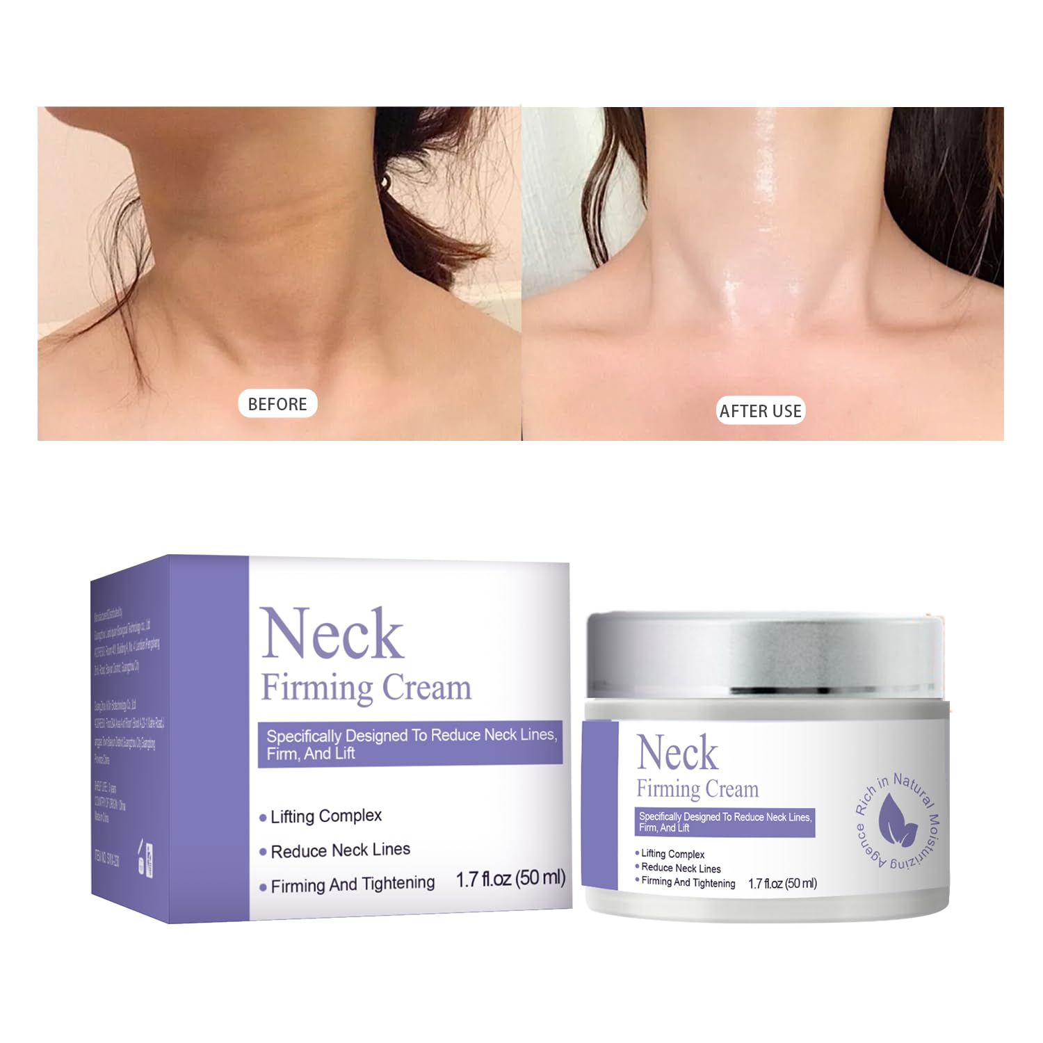IOIOTCO Neck Firming Cream – Tightening, Lifting & Anti-Aging Moisturizer (Face, Neck & Chest) – 1.7 Fl Oz