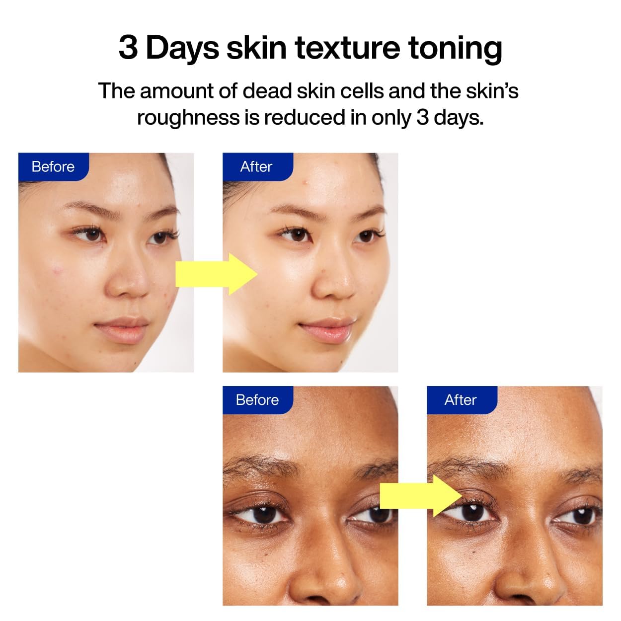 IOPE Gluta Vitamin C Brightening Serum | 25% Pure Vitamin C + 1000ppm Glutathione for Radiant Skin